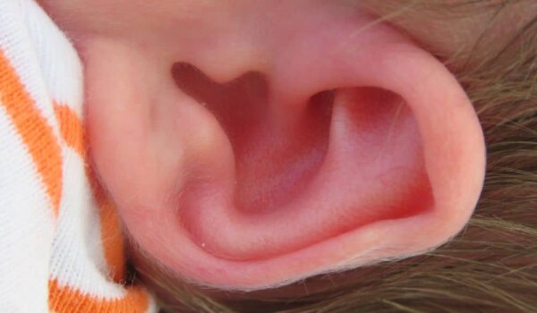 What does it Mean When Your Left Ear is Hot? (Spiritual Meanings & Interpret)